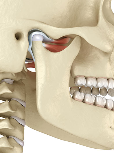 tmj disorder